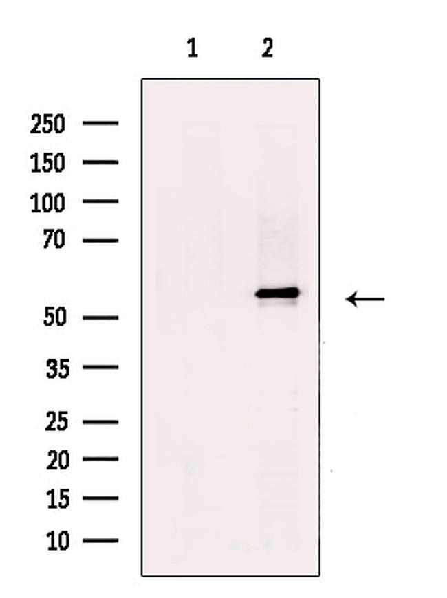 SUV420H2 Antibody in Western Blot (WB)