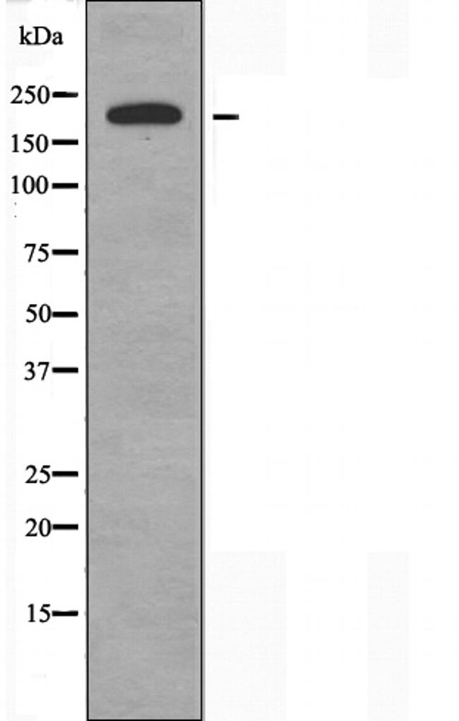 Laminin-221 Antibody in Western Blot (WB)
