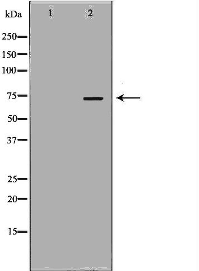 LIMK2 Antibody in Western Blot (WB)