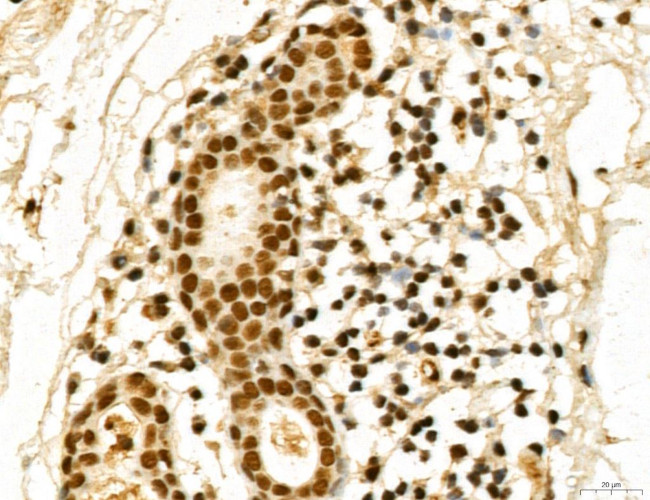 MACC1 Antibody in Immunohistochemistry (Paraffin) (IHC (P))