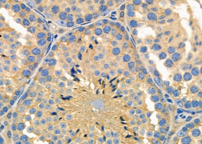 MRPS15 Antibody in Immunohistochemistry (Paraffin) (IHC (P))