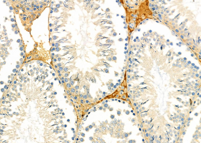 MRPS15 Antibody in Immunohistochemistry (Paraffin) (IHC (P))