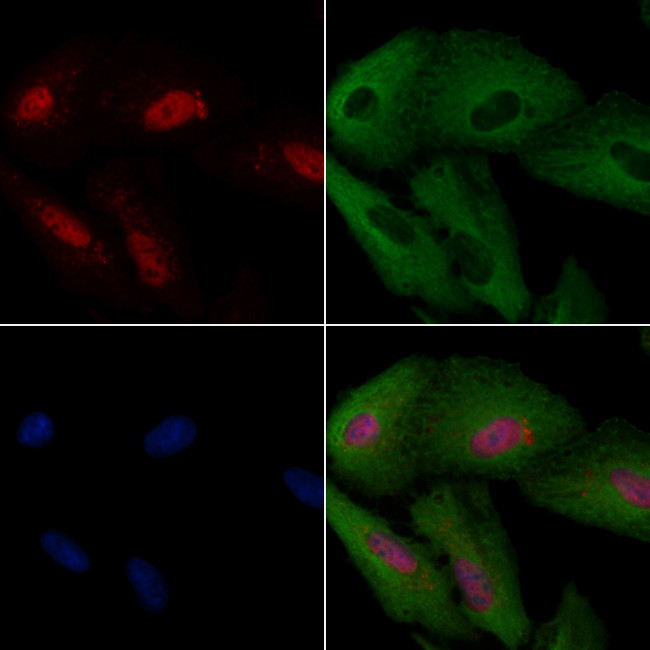 MYF5 Antibody in Immunocytochemistry (ICC/IF)