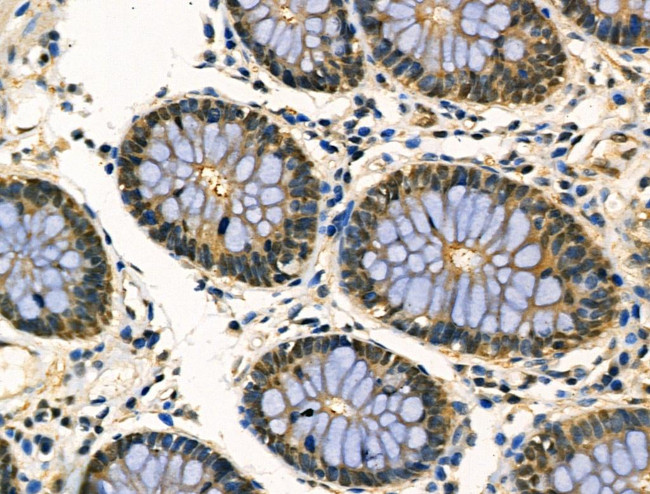 MYF5 Antibody in Immunohistochemistry (Paraffin) (IHC (P))