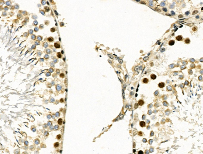 MYF5 Antibody in Immunohistochemistry (Paraffin) (IHC (P))