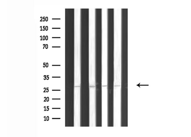 MYF5 Antibody in Western Blot (WB)