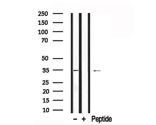 MYOD Antibody in Western Blot (WB)