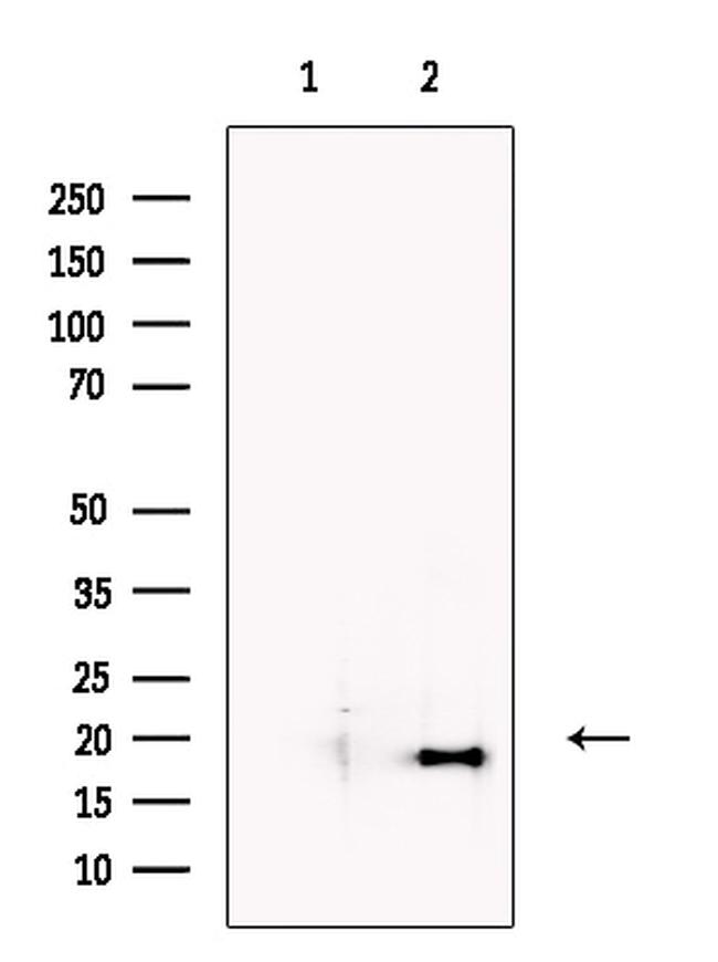 NANOS3 Antibody in Western Blot (WB)