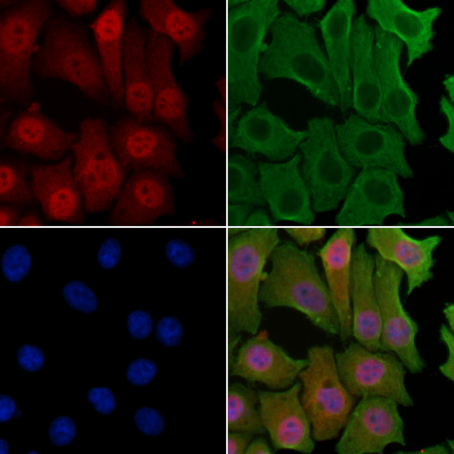 NCBP1 Antibody in Immunocytochemistry (ICC/IF)