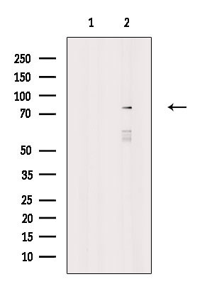 NCBP1 Antibody in Western Blot (WB)