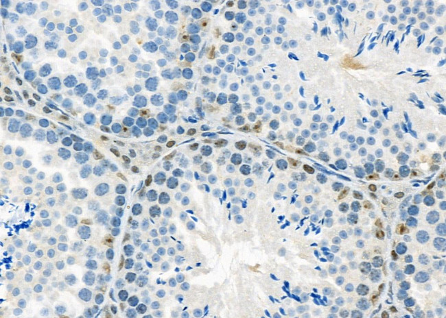 NCKIPSD Antibody in Immunohistochemistry (Paraffin) (IHC (P))