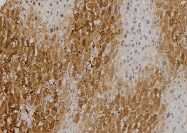 NCOA4 Antibody in Immunohistochemistry (Paraffin) (IHC (P))