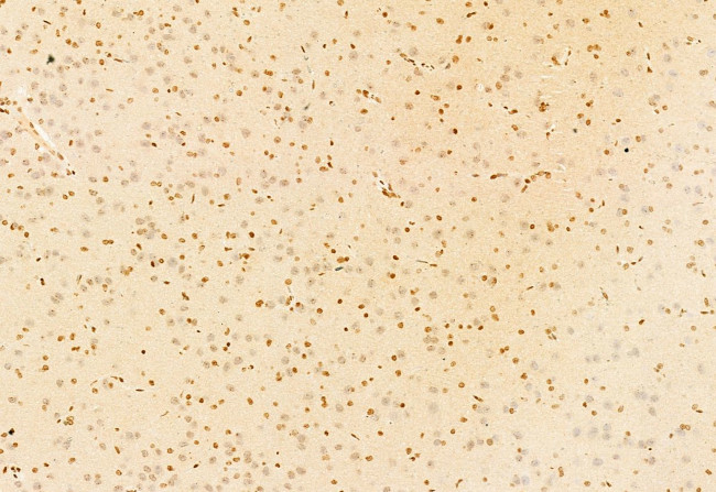 NCOA4 Antibody in Immunohistochemistry (Paraffin) (IHC (P))