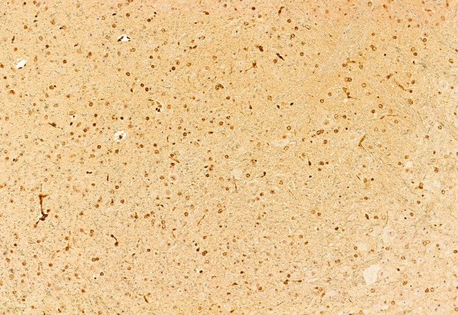 NCOA4 Antibody in Immunohistochemistry (Paraffin) (IHC (P))