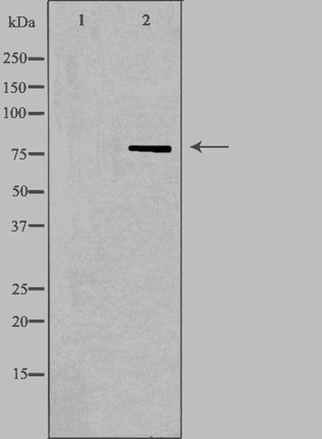 NDUFS1 Antibody in Western Blot (WB)