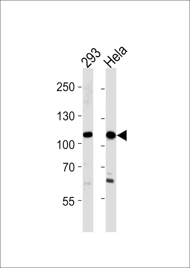 SALL4 Antibody in Western Blot (WB)