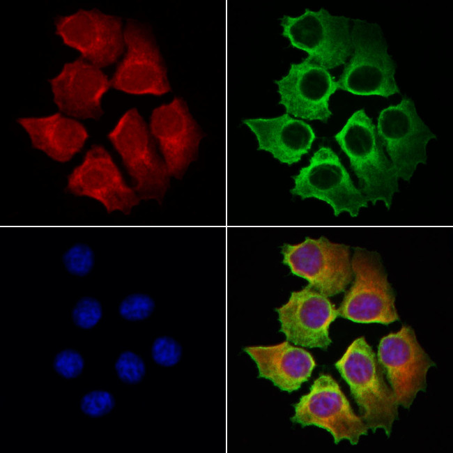 OSBP Antibody in Immunocytochemistry (ICC/IF)