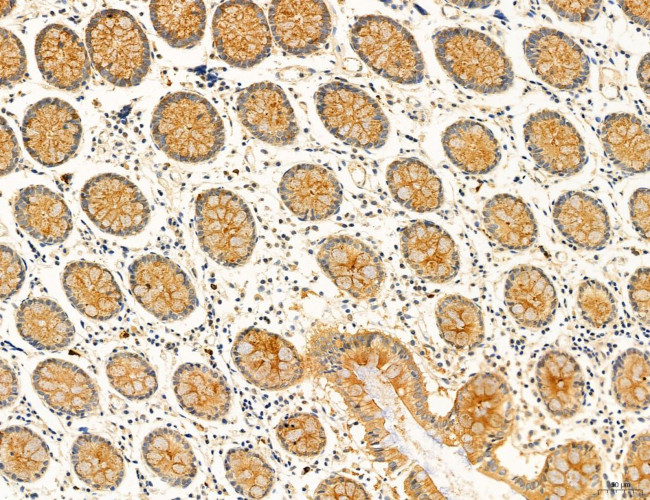 OSBP Antibody in Immunohistochemistry (Paraffin) (IHC (P))