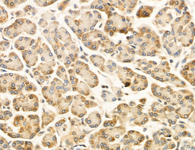 OSBP Antibody in Immunohistochemistry (Paraffin) (IHC (P))