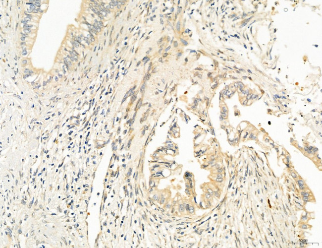 OSBP Antibody in Immunohistochemistry (Paraffin) (IHC (P))