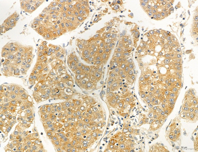 OSBP Antibody in Immunohistochemistry (Paraffin) (IHC (P))