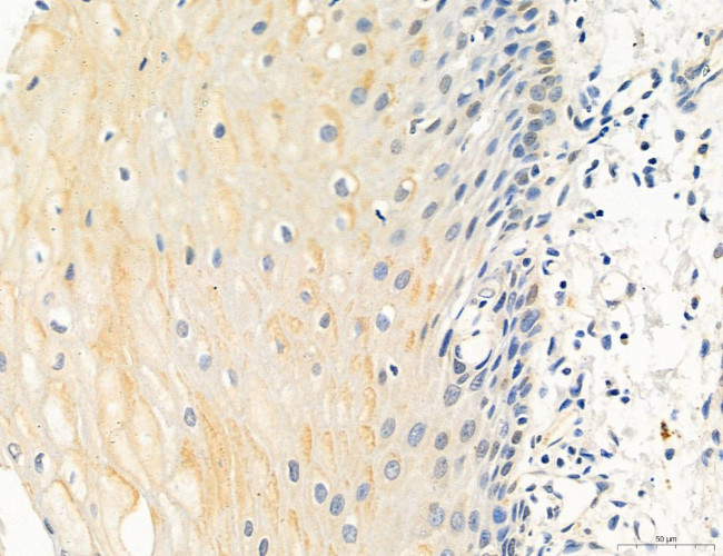 OSBP Antibody in Immunohistochemistry (Paraffin) (IHC (P))