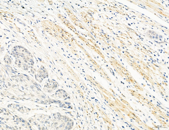 OSBP Antibody in Immunohistochemistry (Paraffin) (IHC (P))