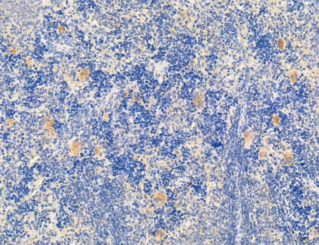 OSBP Antibody in Immunohistochemistry (Paraffin) (IHC (P))