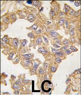 Actin Antibody in Immunohistochemistry (Paraffin) (IHC (P))