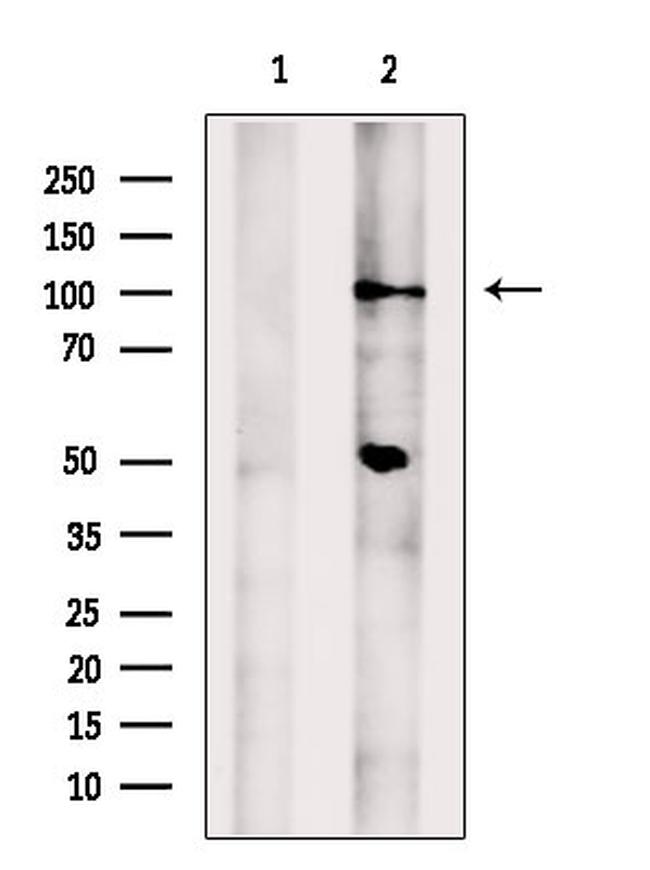 PDE11A Antibody in Western Blot (WB)