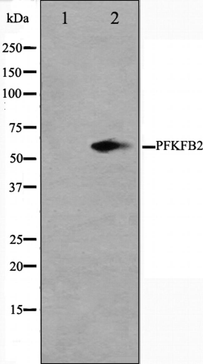 PFKFB2 Antibody in Western Blot (WB)