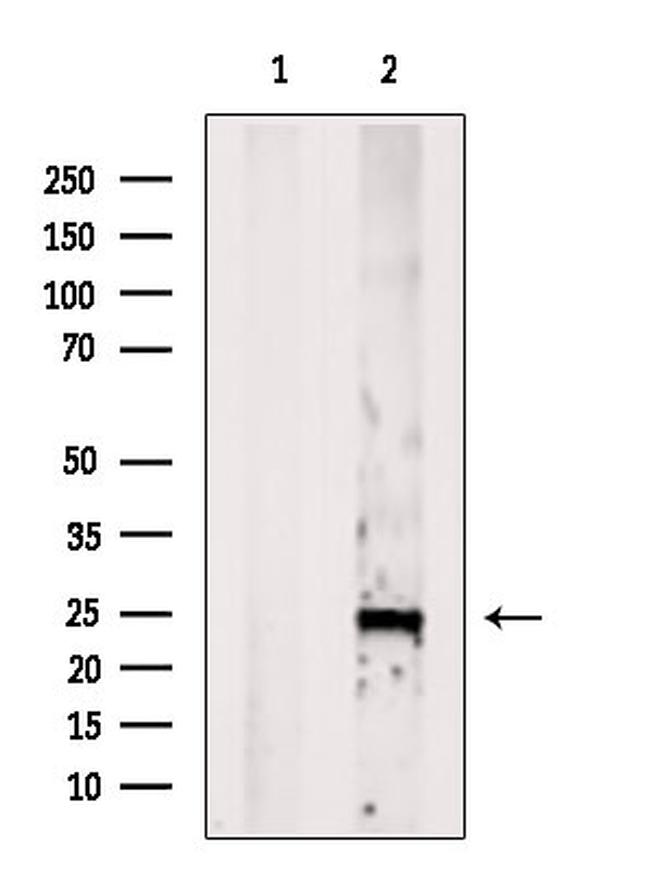 Phospholamban Antibody in Western Blot (WB)
