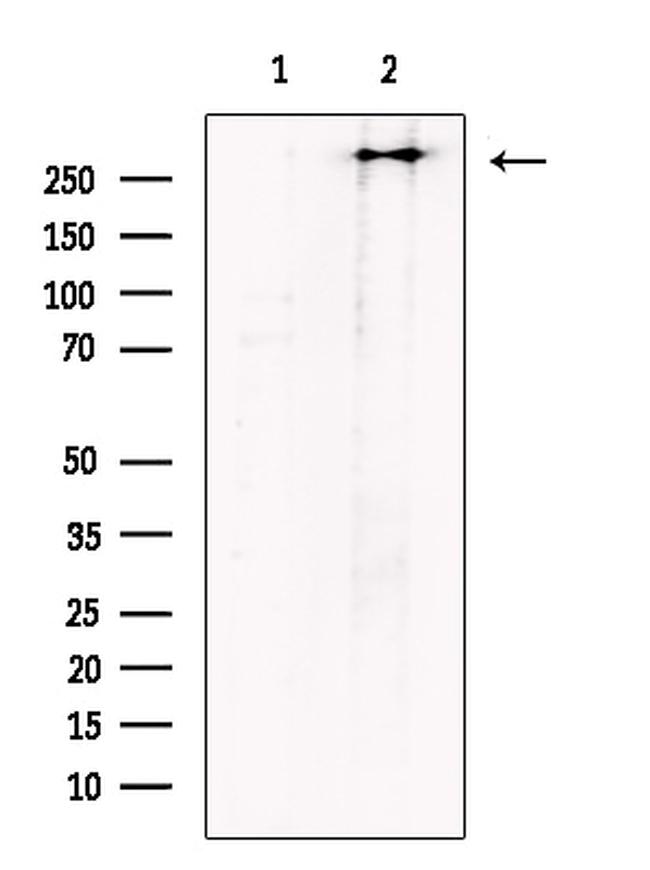 Polycystin 1 Polyclonal Antibody (PA5-115779)