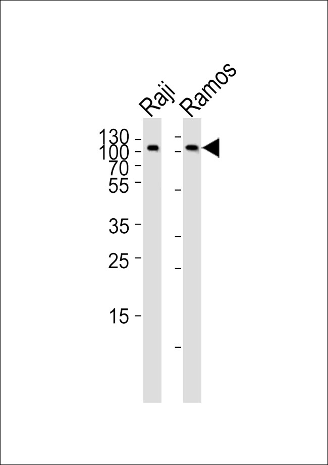 CD19 Antibody in Western Blot (WB)