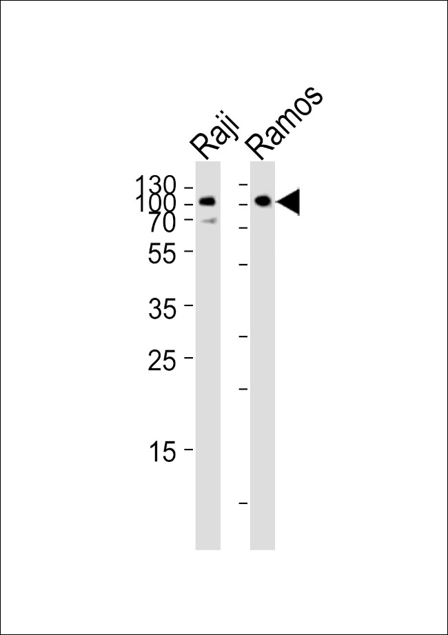 CD19 Antibody in Western Blot (WB)