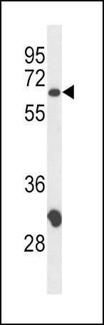 CD4 Antibody in Western Blot (WB)