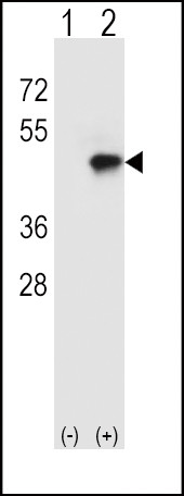 CD4 Antibody in Western Blot (WB)