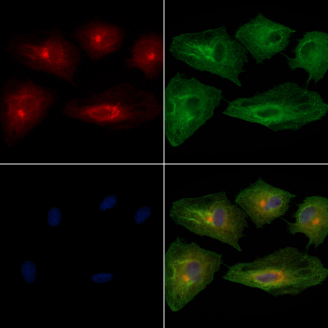 RAB17 Antibody in Immunocytochemistry (ICC/IF)