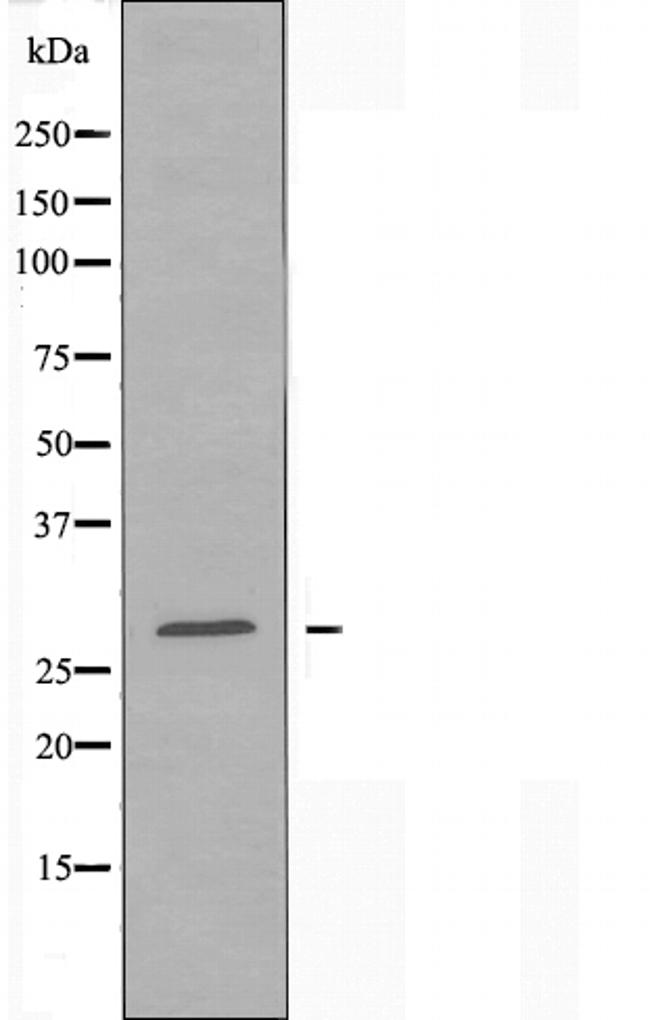 RAB20 Antibody in Western Blot (WB)