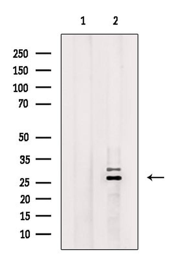 RAB29 Antibody in Western Blot (WB)