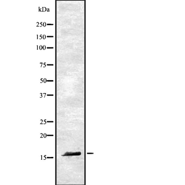 RAMP1 Antibody in Western Blot (WB)