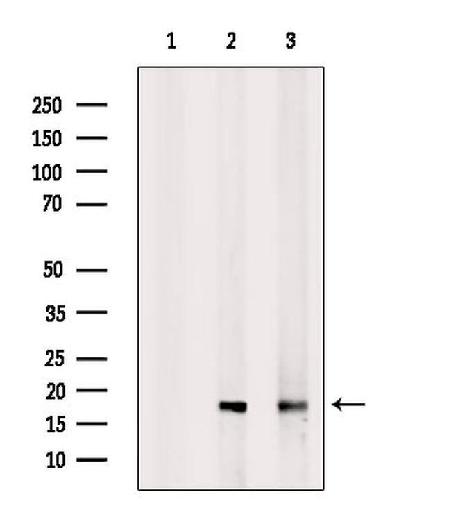 RBM3 Antibody in Western Blot (WB)