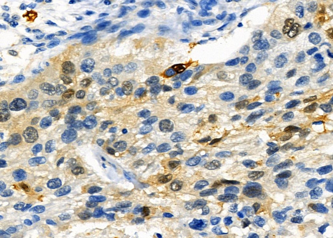 SATB2 Antibody in Immunohistochemistry (Paraffin) (IHC (P))