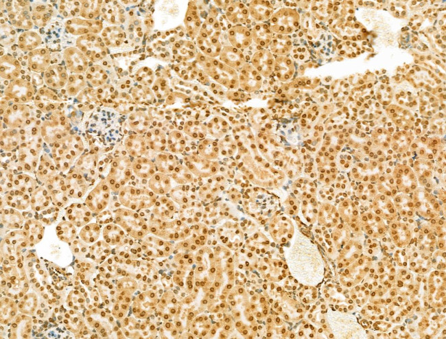 SCXA Antibody in Immunohistochemistry (Paraffin) (IHC (P))