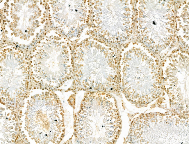 SCXA Antibody in Immunohistochemistry (Paraffin) (IHC (P))