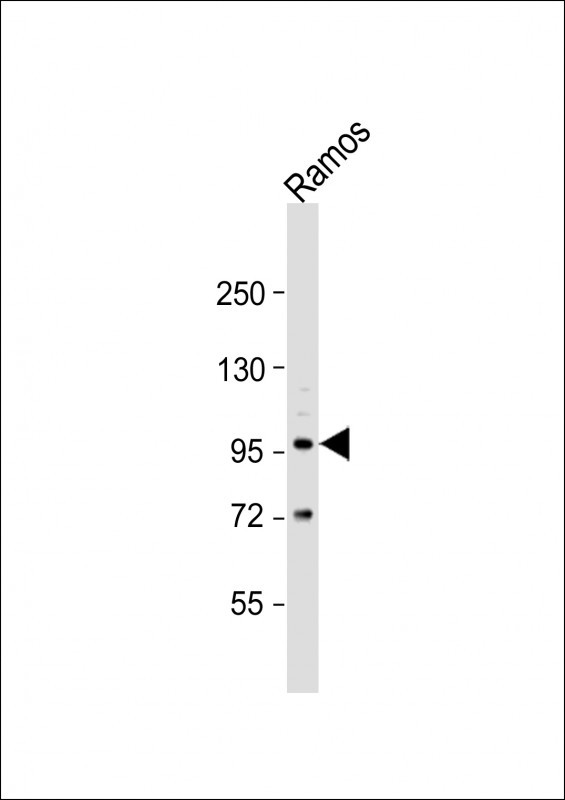 TLR2 Antibody in Western Blot (WB)