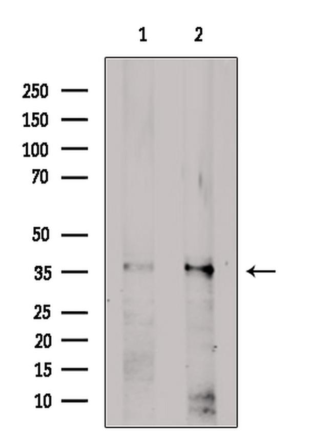 ZIP1 Antibody in Western Blot (WB)