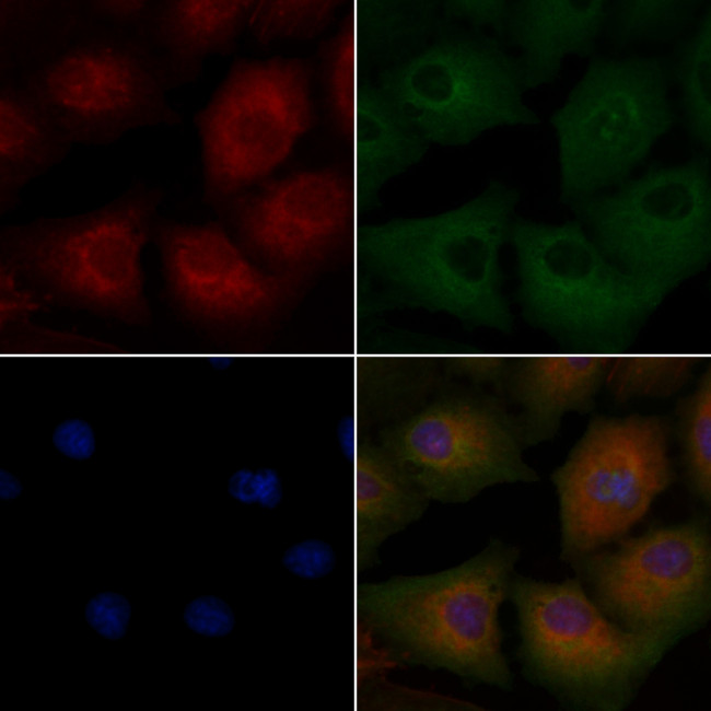 TAGLN Antibody in Immunocytochemistry (ICC/IF)