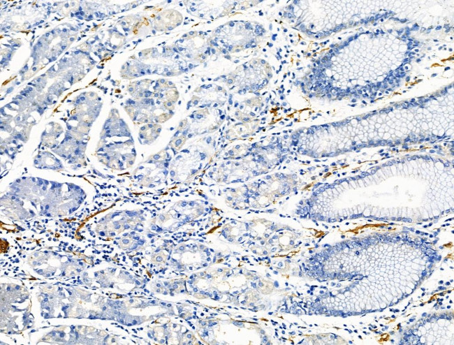 TAGLN Antibody in Immunohistochemistry (Paraffin) (IHC (P))