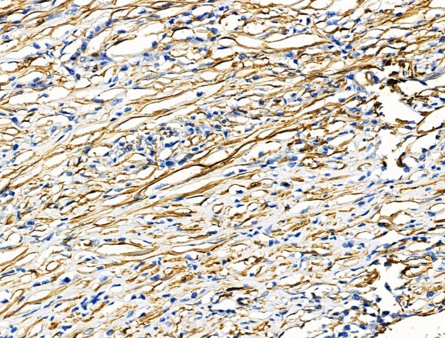 TAGLN Antibody in Immunohistochemistry (Paraffin) (IHC (P))